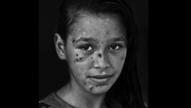 foto van het jonge meisje Dalia Khalifa, getroffen door Israëlisch shrapnel